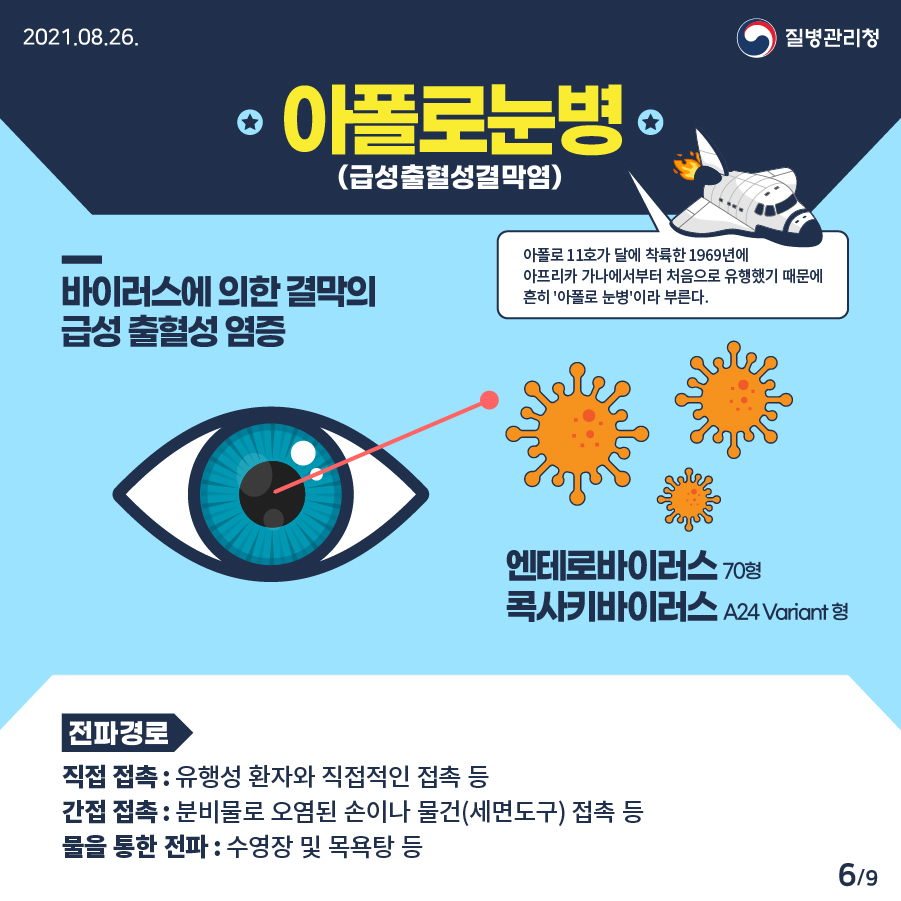 2021년 8월 26일 질병관리청 아폴로눈병(급성출혈성결막염). 바이러스(엔테로바이러스 70형, 콕사키바이러스 A24 Variant형)에 의한 결막의 급성 출혈성 염증. 아폴로 11호가 달에 착륙한 1969년에 아프리카 가나에서부터 처음으로 유행했기 때문에 흔히 '아폴로 눈병'이라 부른다. 9페이지 중 6페이지